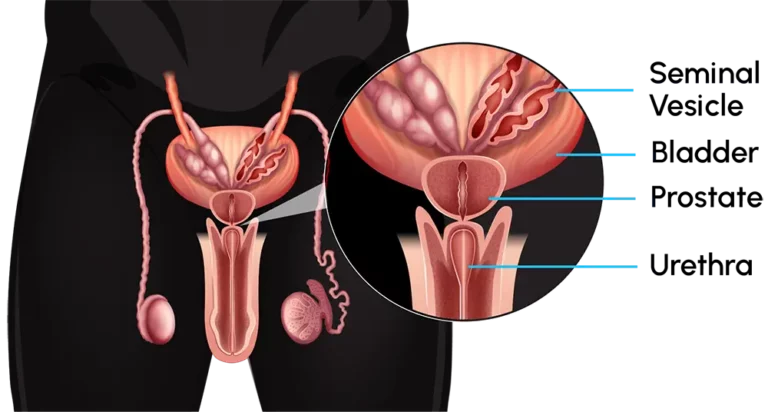 Prostate location and anatomy